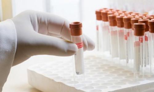 醫療器械經(jīng)營(yíng)注冊